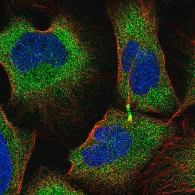 Anti-TRIM45 antibody produced in rabbit