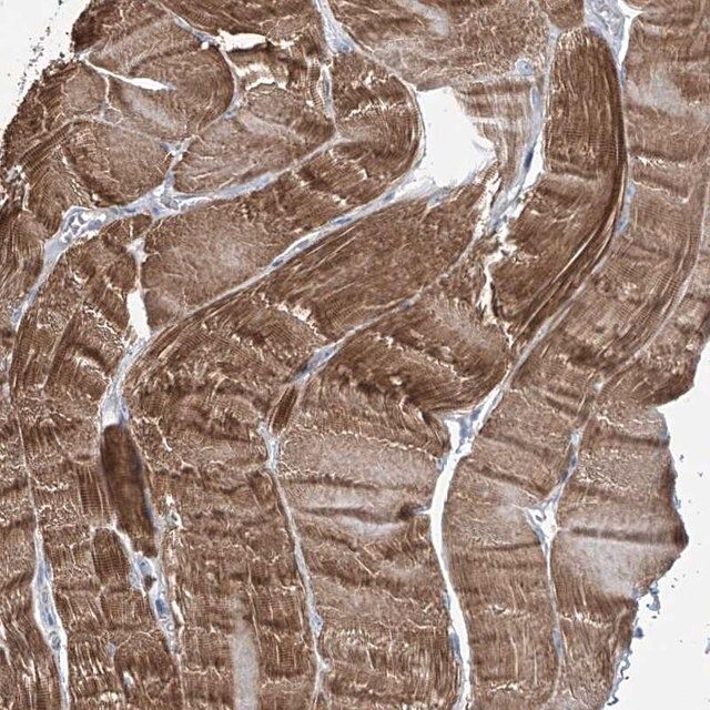 Anti-TRIM60 antibody produced in rabbit