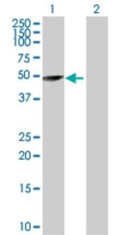 Anti-TRIM62 antibody produced in rabbit