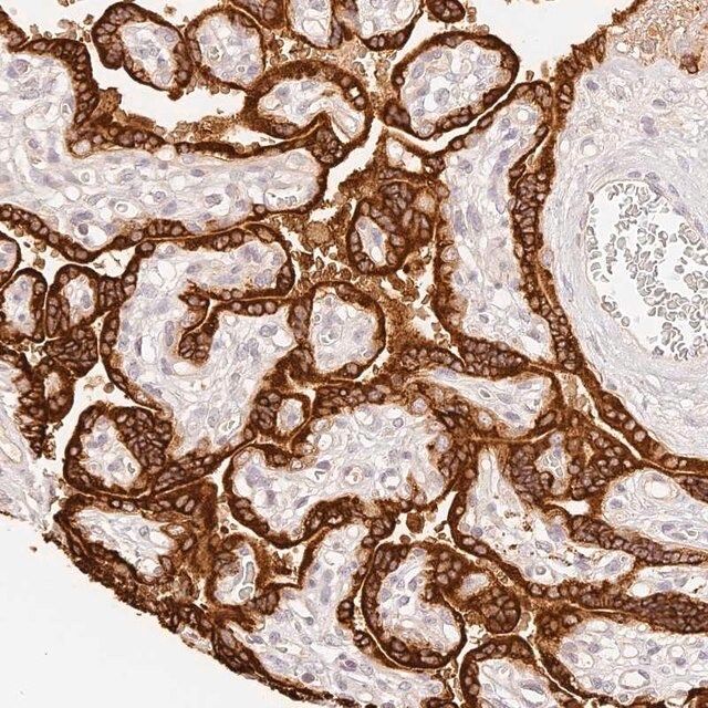 Anti-TRIM45 antibody produced in rabbit