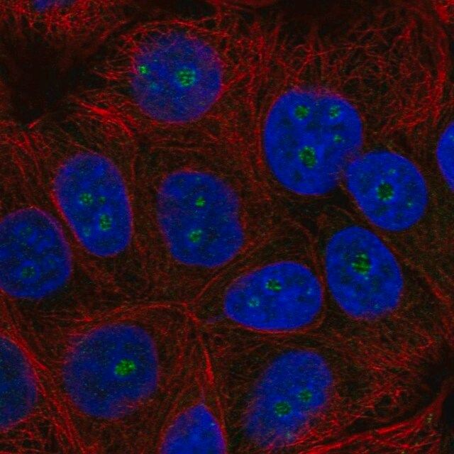 Anti-TRIM52 antibody produced in rabbit