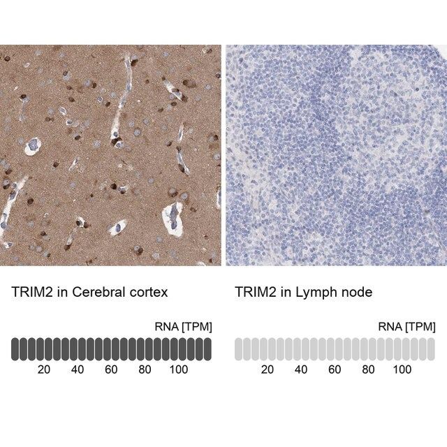 Anti-TRIM2 antibody produced in rabbit