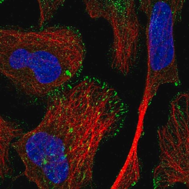 Anti-TRIM62 antibody produced in rabbit