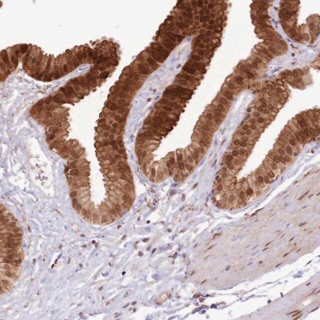 Anti-TRIM32 antibody produced in rabbit