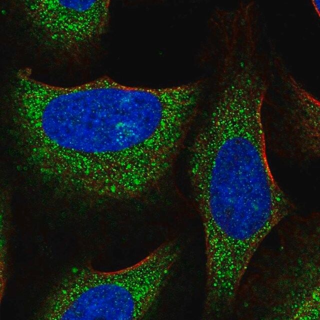 Anti-TRIM39 antibody produced in rabbit