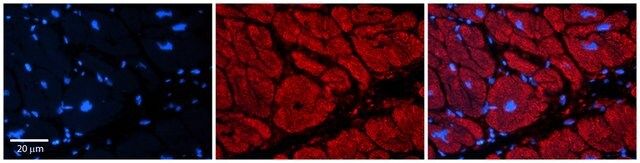 Anti-TRIM39 antibody produced in rabbit