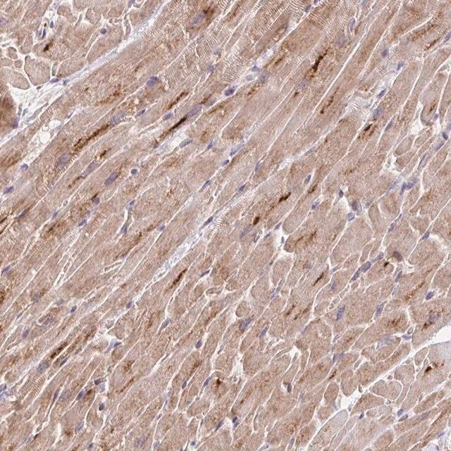 Anti-TRIM55 antibody produced in rabbit