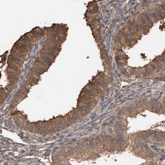 Anti-TRIM5 antibody produced in rabbit