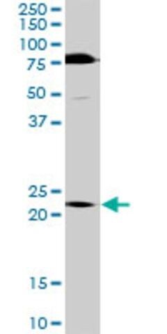 Anti-TRIM55 antibody produced in rabbit