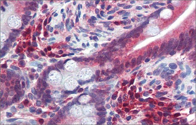 Anti-TRIM35 antibody produced in rabbit