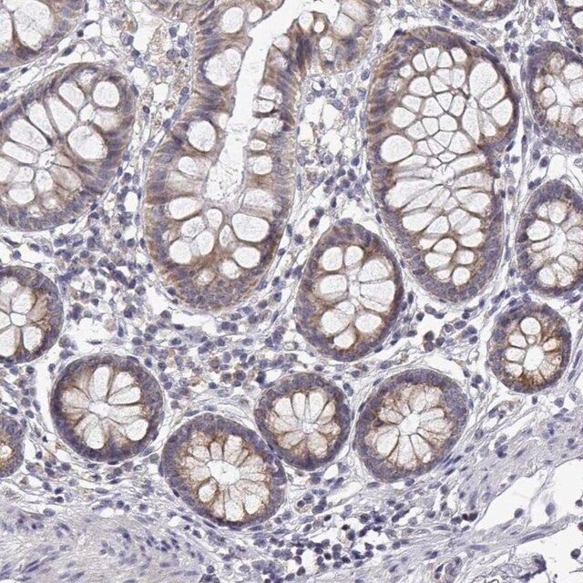 Anti-TRIM60 antibody produced in rabbit