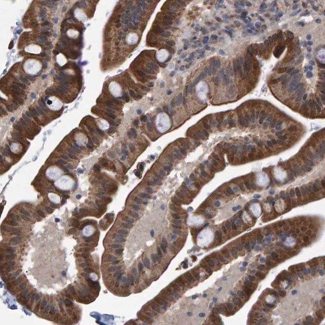 Anti-TRIM68 antibody produced in rabbit