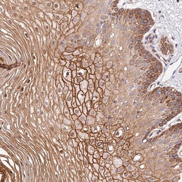 Anti-TRIM43 antibody produced in rabbit