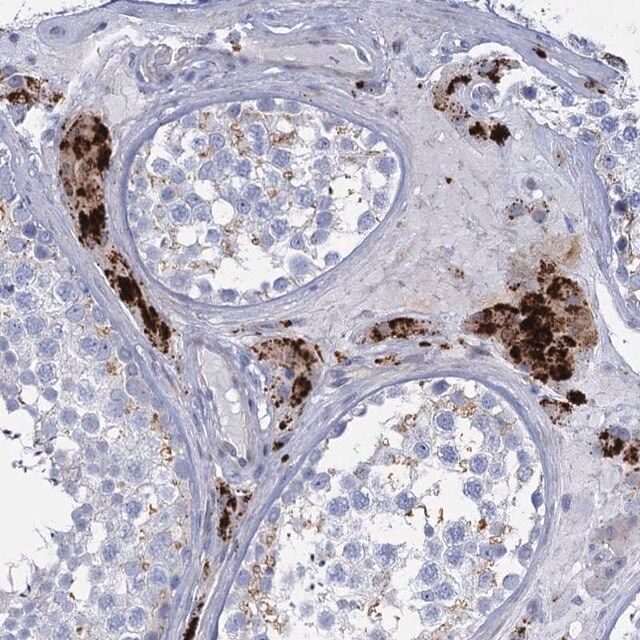 Anti-TRIM77 antibody produced in rabbit