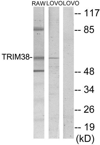 Anti-TRIM38 antibody produced in rabbit