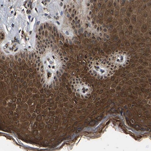 Anti-TRIM35 antibody produced in rabbit