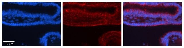 Anti-TRIM32 antibody produced in rabbit