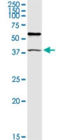 Anti-TRIM63 antibody produced in rabbit