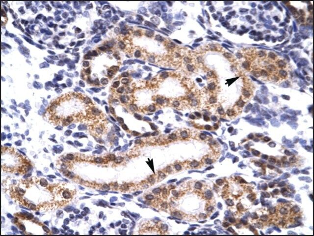 Anti-TRIM3 antibody produced in rabbit