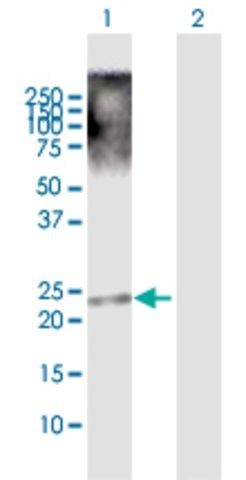 Anti-TRIML1 antibody produced in rabbit