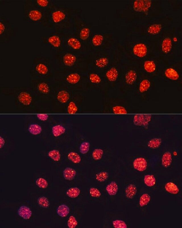 Anti-TriMethyl-Histone H3-K56 antibody produced in rabbit