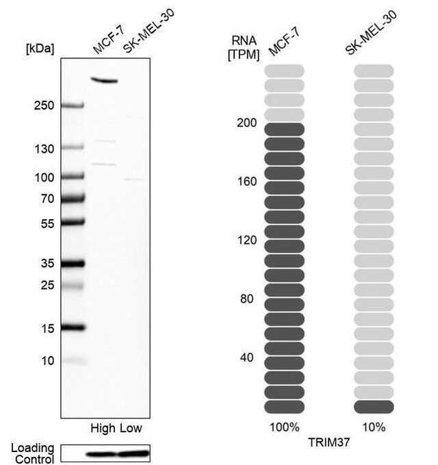 Anti-TRIM37 antibody produced in rabbit