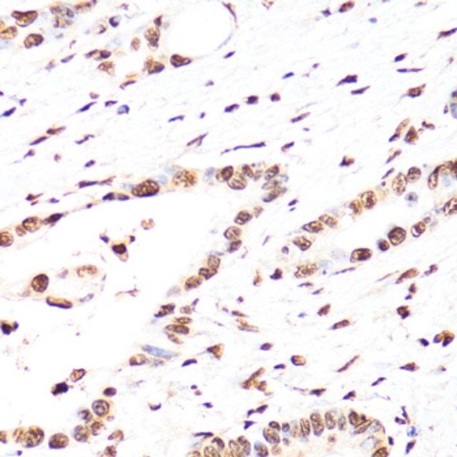 Anti-TriMethyl-Histone H3-K27 antibody produced in mouse