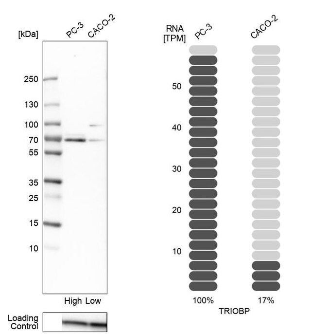 Anti-TRIOBP antibody produced in rabbit