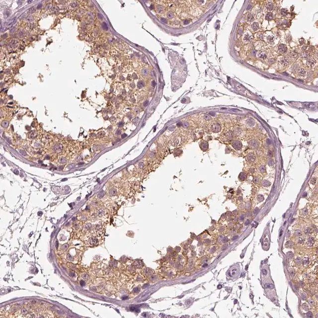 Anti-TRIM69 antibody produced in rabbit