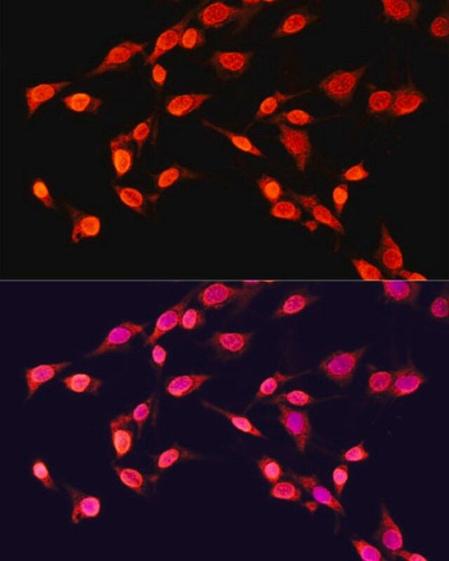 Anti-TriMethyl-Histone H3-K14 antibody produced in rabbit