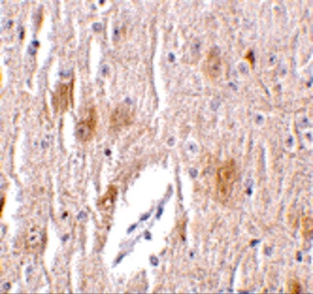 Anti-TRIM5 delta antibody produced in rabbit