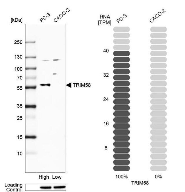 Anti-TRIM58 antibody produced in rabbit