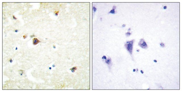 Anti-TRIM3 antibody produced in rabbit