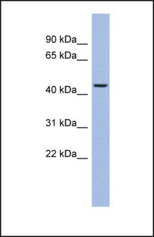 Anti-TRIOBP antibody produced in rabbit