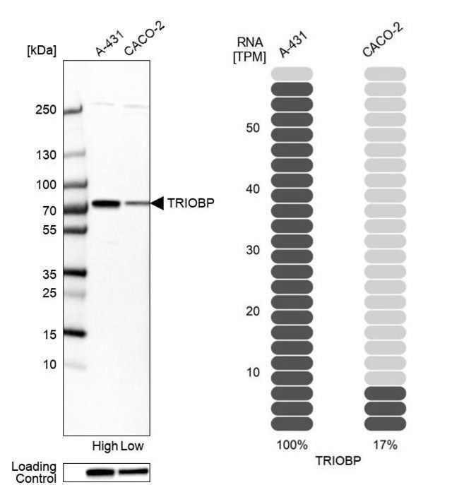 Anti-TRIOBP antibody produced in rabbit