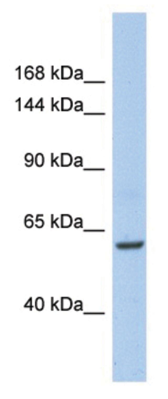 Anti-TRIO (C-terminal) antibody produced in rabbit