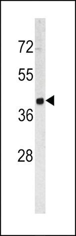 ANTI-TROP2 (CENTER) antibody produced in rabbit