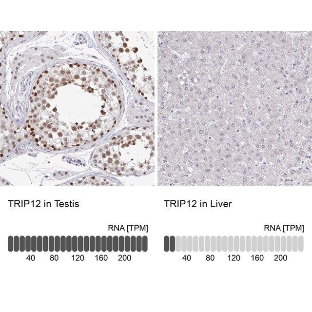 Anti-TRIP12 antibody produced in rabbit