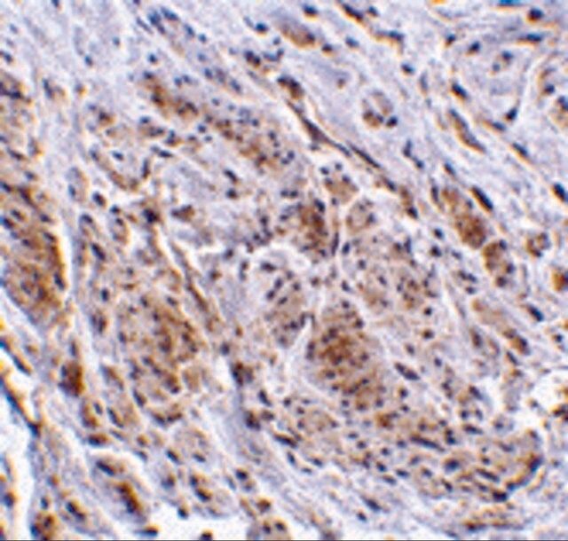 Anti-TRIM5 gamma antibody produced in rabbit