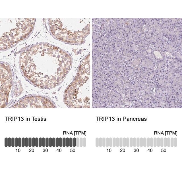 Anti-TRIP13 antibody produced in rabbit