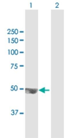 Anti-TRMT12 antibody produced in mouse