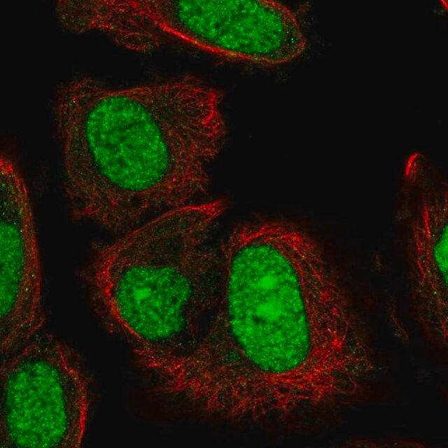 Anti-TRMT6 antibody produced in rabbit