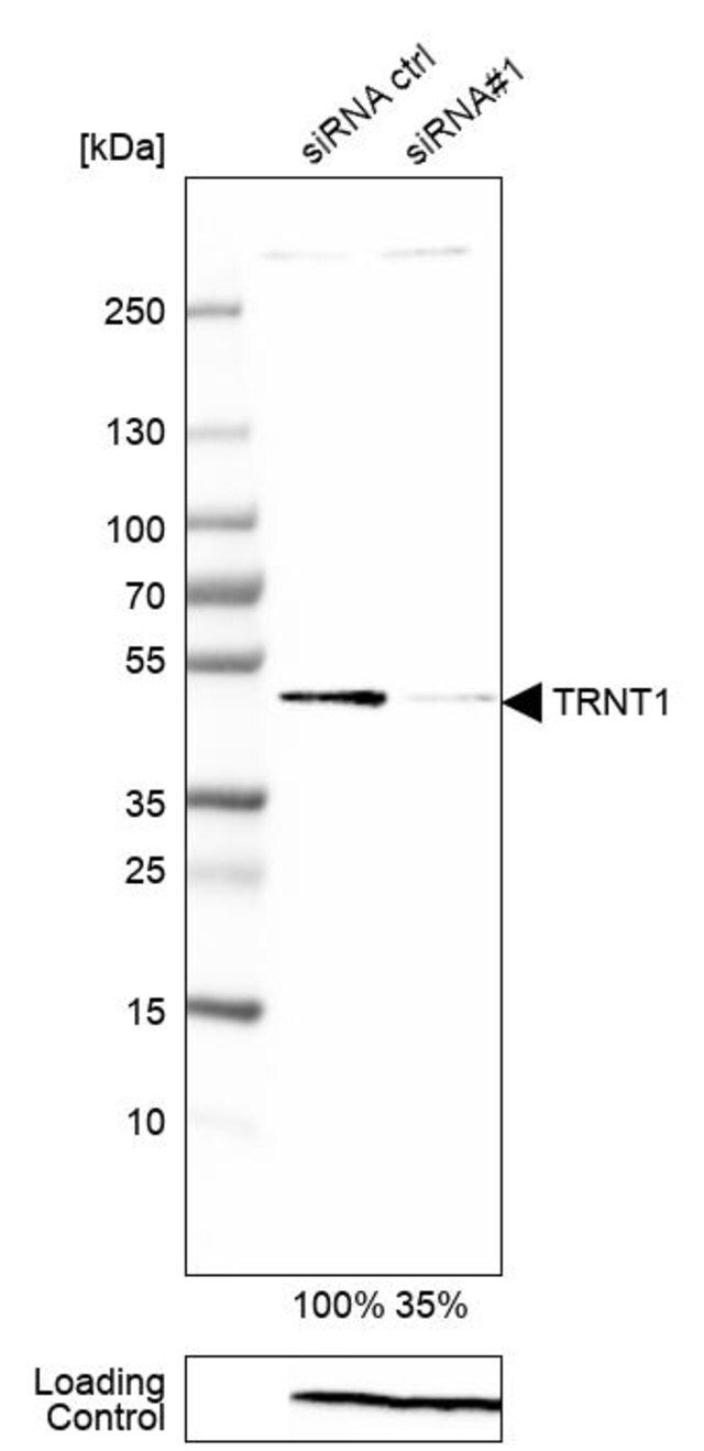 Anti-TRNT1 antibody produced in rabbit