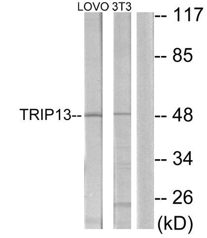 Anti-TRIP13 antibody produced in rabbit