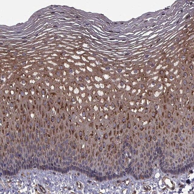 Anti-TRIP10 antibody produced in rabbit