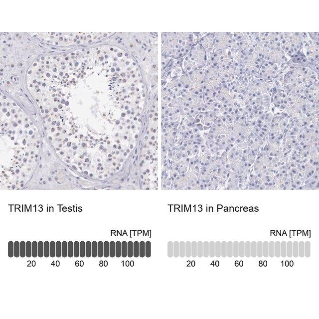 Anti-TRIM13 antibody produced in rabbit