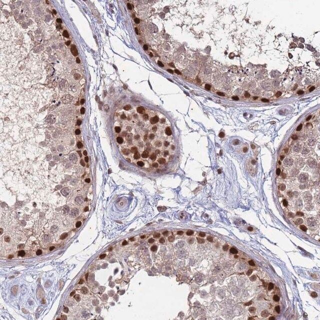 Anti-TRMT6 antibody produced in rabbit