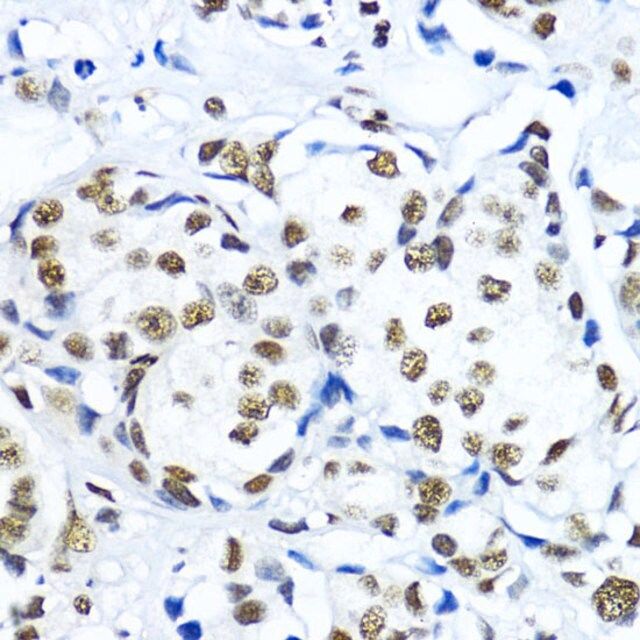 Anti-TriMethyl-Histone H3-K79 antibody produced in rabbit