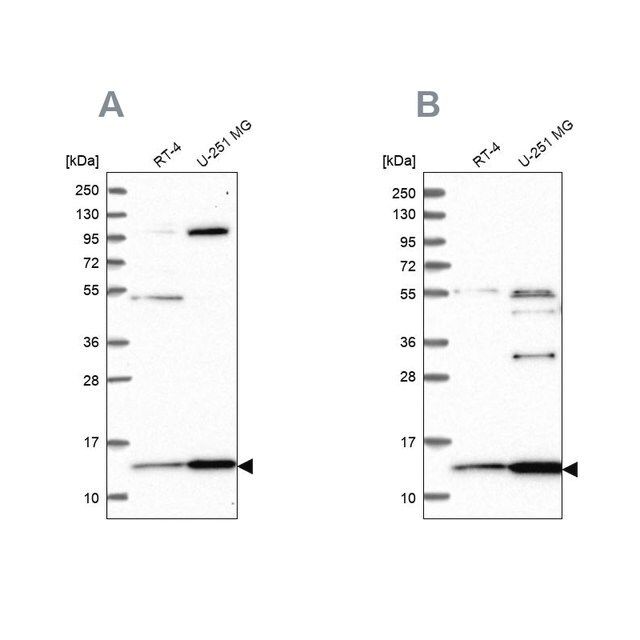 Anti-TRMT112 antibody produced in rabbit