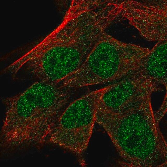 Anti-TRNAU1AP antibody produced in rabbit